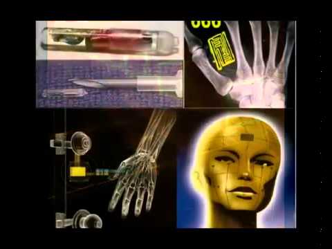 διαλέγετε που θα το τοποθετήσετε σας βολεύει στο χέρι ή στο μέτωπο;